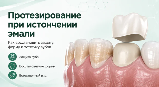 Картинка статьи